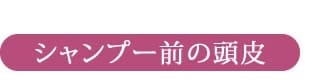 シャンプー前の頭皮