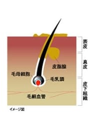 シャンプー前の頭皮(イメージ図)
