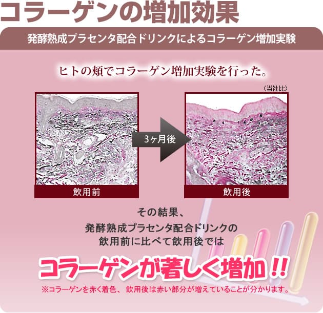 コラーゲン
